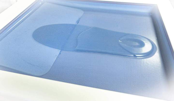 Fabrication semelle orthopédique Riom